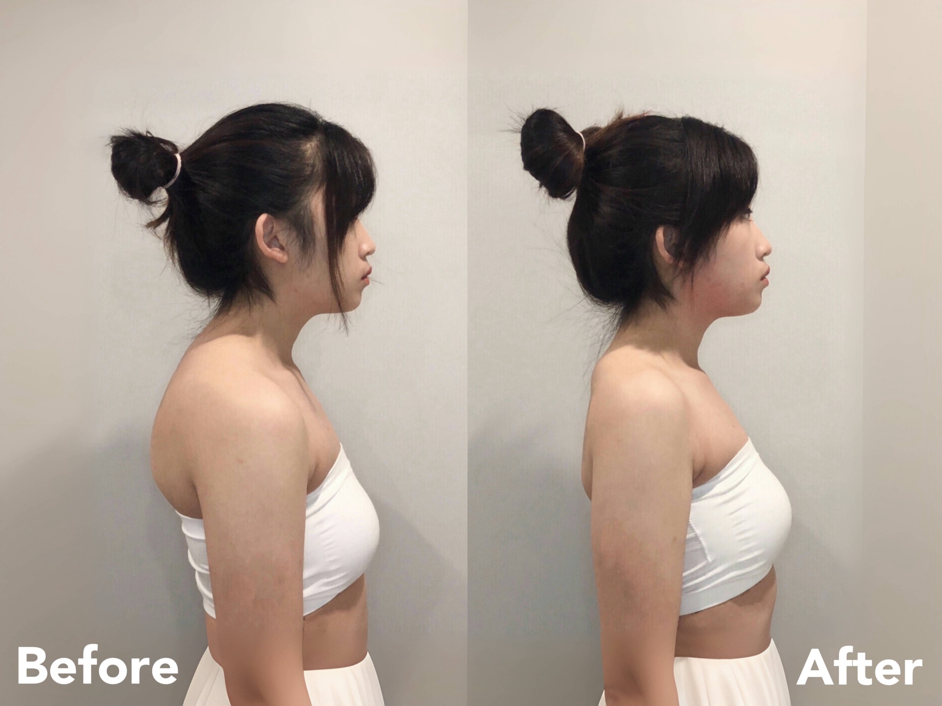Female posture alignment before and after — full body postural rebalancing