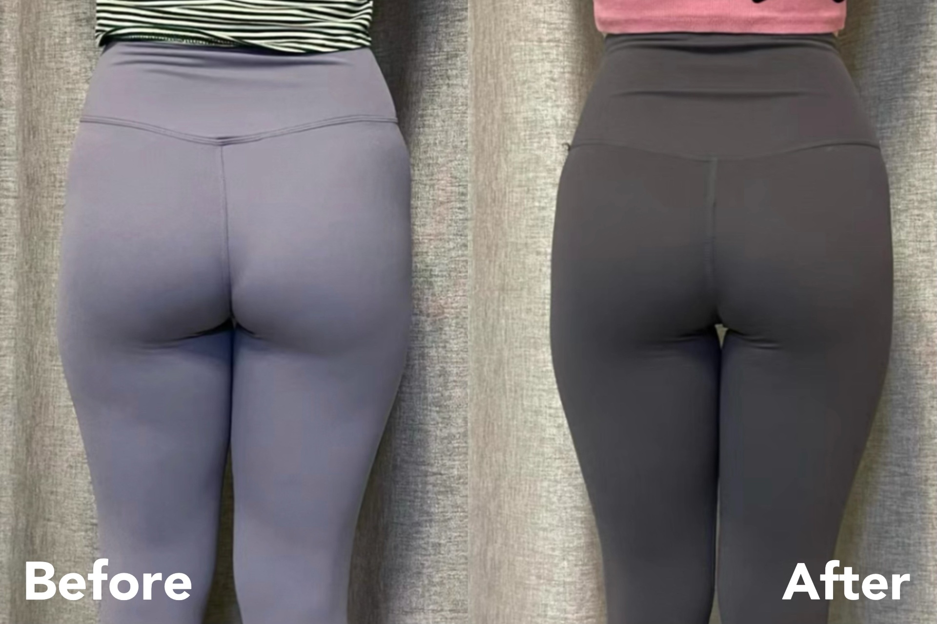 Pelvic Alignment — before and after transformation
