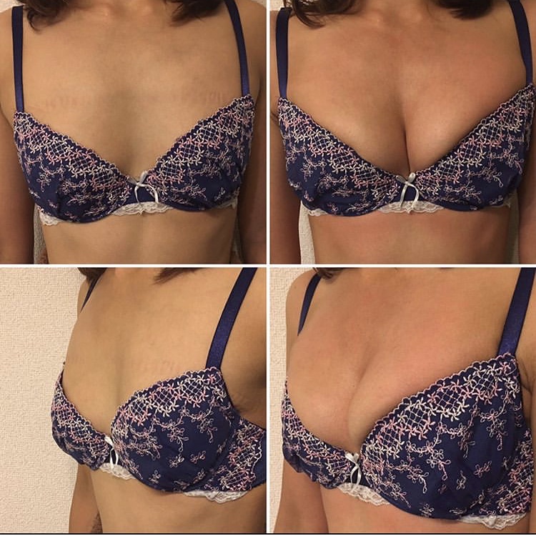 Cleavage and projection — case 1 before and after