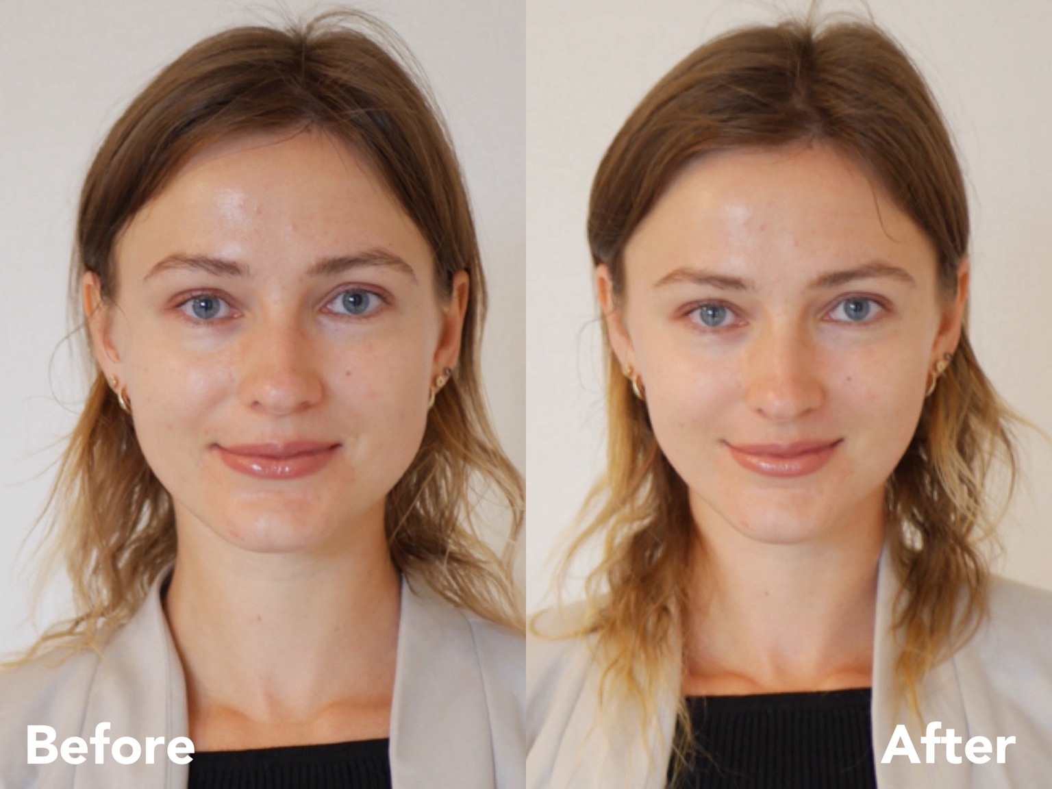 Natural lift and refined contours — before and after