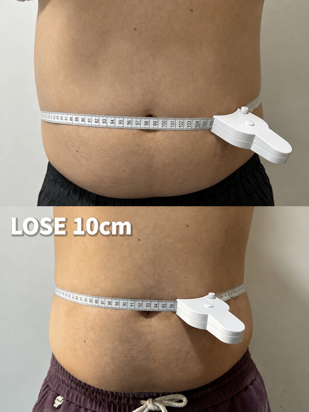 Waist measurement — 10cm waist reduction before and after