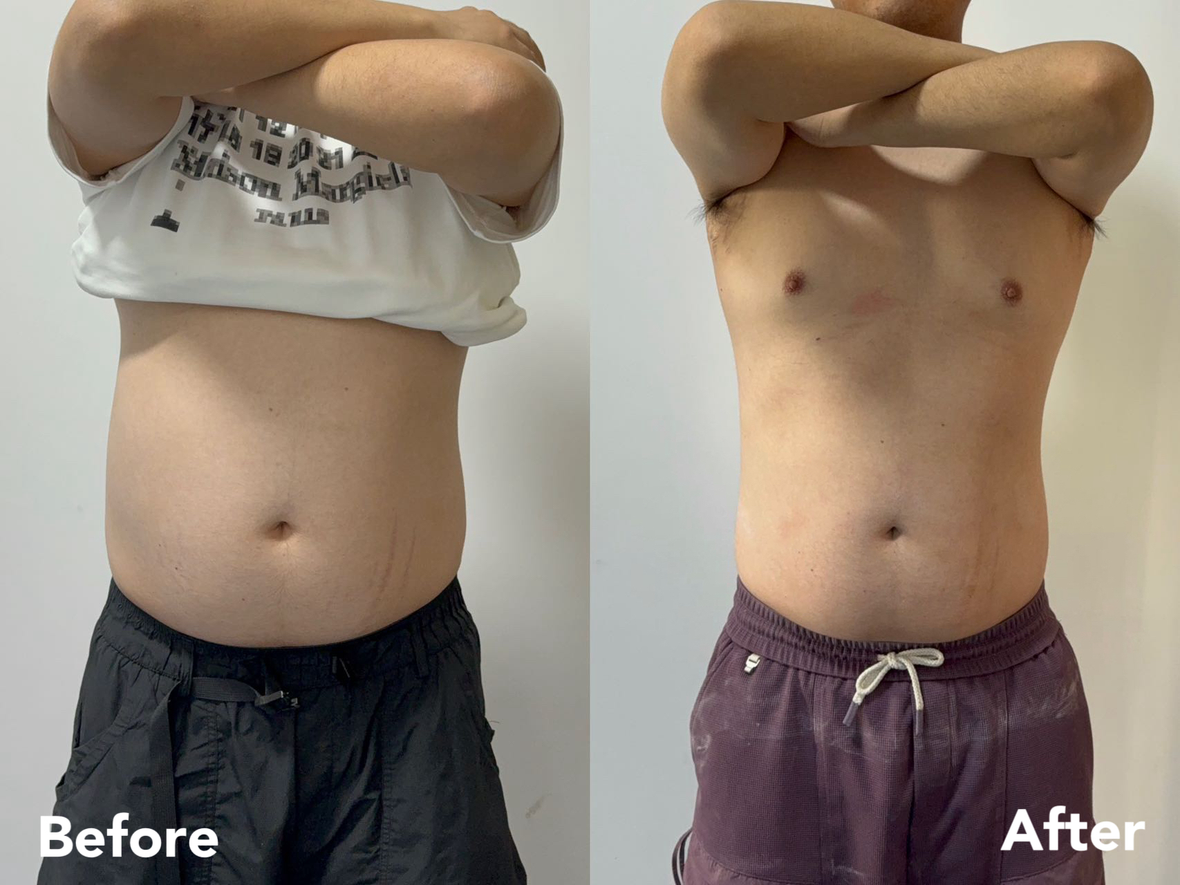 28-day male body reset — front before and after