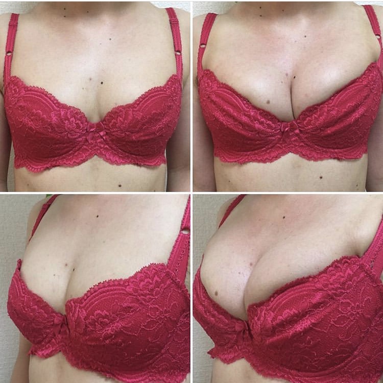 Cleavage and projection — case 2 before and after